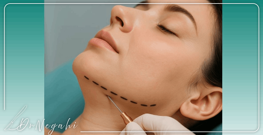 جراحی ساکشن غبغب؛ راهکاری برای حذف چربی‌های زیر چانه