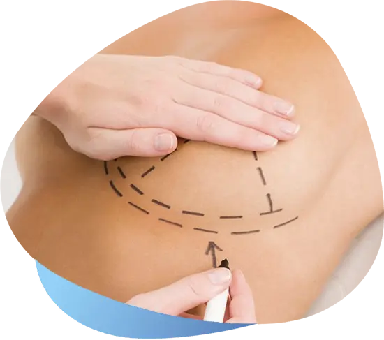 header mammoplasty 1