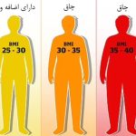 اهمیت BMI در انجام عمل ابدومینوپلاستی 5 اهمیت BMI در انجام عمل ابدومینوپلاستی