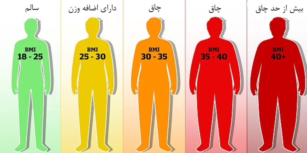 اهمیت BMI در انجام عمل ابدومینوپلاستی