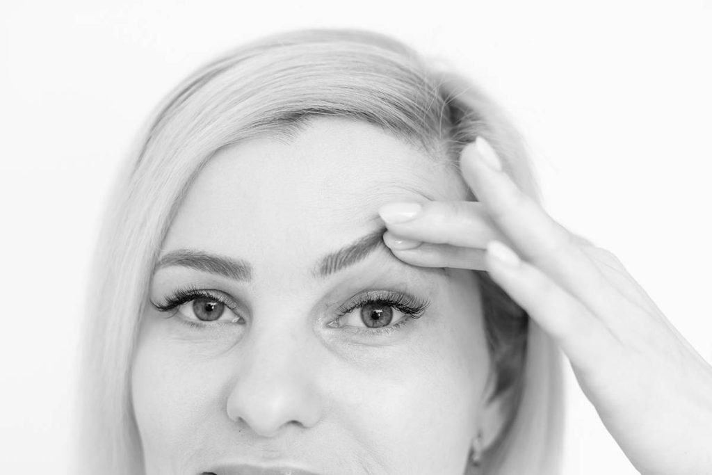 ترمیم بلفاروپلاستی