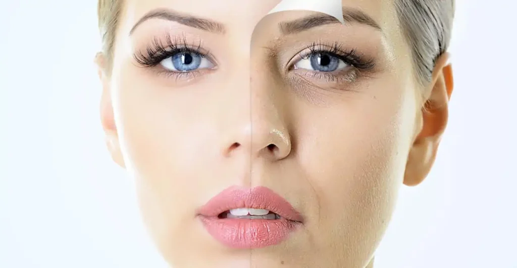 عوامل مؤثر بر ماندگاری بلفاروپلاستی